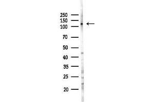 anti-SH3 and PX Domains 2B (SH3PXD2B) antibody