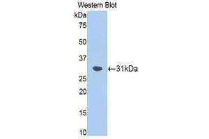 Western Blotting (WB) image for anti-Fascin (FSCN1) (AA 8-260) antibody (ABIN1174989) (Fascin 抗体  (AA 8-260))