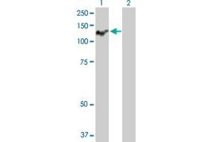Western Blot analysis of ATP2C1 expression in transfected 293T cell line by ATP2C1 MaxPab polyclonal antibody. (ATP2C1 抗体  (AA 1-919))