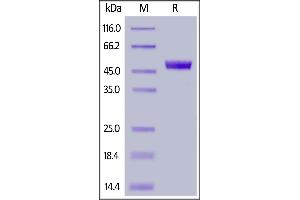 SDS-PAGE (SDS) image for CD4 (CD4) (AA 26-390) (Active) protein (FITC,His tag) (ABIN6933655)