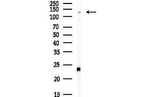 anti-Activating Transcription Factor 7 Interacting Protein (ATF7IP) antibody