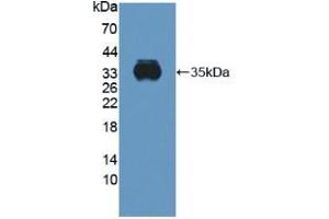 Detection of Recombinant CYBb, Human using Polyclonal Antibody to Cytochrome b-245 Beta Polypeptide (CYBb) (CYBB 抗体  (AA 283-570))
