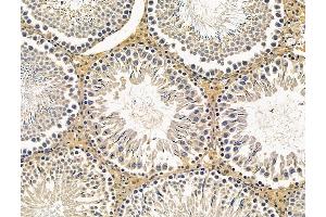 ABIN7096236 and ABIN7100298 at 1/100 staining rat testis tissue by IHC-P. (SYDE2 抗体)