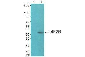Western blot analysis of extracts from JK cells (Lane 2), using eIF2B (Ab-67) antiobdy. (EIF2S2 抗体  (N-Term))