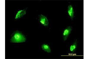 Immunofluorescence of purified MaxPab antibody to GOLGA2 on HepG2 cell. (Golgin A2 (GOLGA2) (AA 1-990) 抗体)