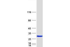 Validation with Western Blot (TPD52 Protein (Transcript Variant 3) (Myc-DYKDDDDK Tag))