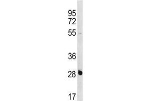 RBPMS antibody western blot analysis in NCI-H460 lysate. (RBPMS 抗体  (AA 166-193))