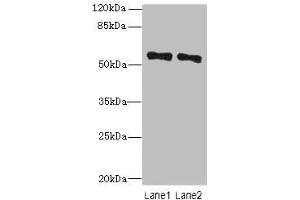 Western blot All lanes: ZNF689 antibody at 5 μg/mL Lane 1: Hela whole cell lysate Lane 2: HepG2 whole cell lysate Secondary Goat polyclonal to rabbit IgG at 1/10000 dilution Predicted band size: 57 kDa Observed band size: 57 kDa (ZNF689 抗体  (AA 1-300))