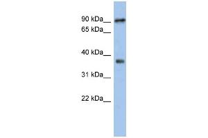 WB Suggested Anti-RSPH10B Antibody Titration: 0. (RSPH10B 抗体  (Middle Region))