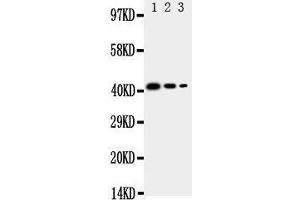Lane 3: Recombinant Human CD68 Protein 2. (CD68 抗体  (C-Term))