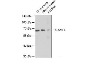 Western blot analysis of extracts of various cell lines using SLAMF6 Polyclonal Antibody at dilution of 1:1000. (SLAMF6 抗体)