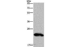 Western blot analysis of Human placenta tissue, using GH2 Polyclonal Antibody at dilution of 1:500