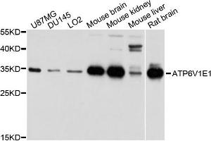 Western blot analysis of extracts of various cells, using ATP6V1E1 antibody. (ATP6V1E1 抗体)