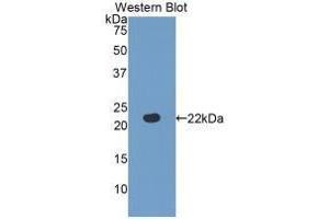 Western blot analysis of the recombinant protein. (Fibulin 5 抗体  (AA 277-448))