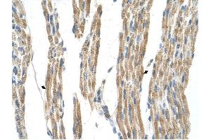 GPT antibody was used for immunohistochemistry at a concentration of 4-8 ug/ml to stain Skeletal muscle cells (arrows) in Human Muscle. (ALT 抗体)