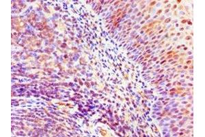 Immunohistochemistry of paraffin-embedded human tonsil tissue using ABIN7169428 at dilution of 1:100 (ASH2L 抗体  (AA 329-628))