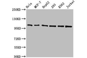 Western Blot Positive WB detected in: Hela whole cell lysate, MCF-7 whole cell lysate, HepG2 whole cell lysate, 293 whole cell lysate, K562 whole cell lysate, Jurkat whole cell lysate All lanes: CDC5L antibody at 1. (Recombinant CDC5L 抗体)