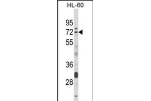 Western blot analysis of DTX4 Antibody (N-term) (ABIN652817 and ABIN2842533) in HL-60 cell line lysates (35 μg/lane). (Deltex Homolog 4 抗体  (N-Term))