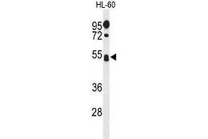 Western blot analysis of SPN Antibody (Center) in HL-60 cell line lysates (35µg/lane). (CD43 抗体  (Middle Region))