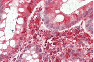 ABIN768660 (5µg/ml) staining of paraffin embedded Human Colon. (TFB2M 抗体  (Internal Region))
