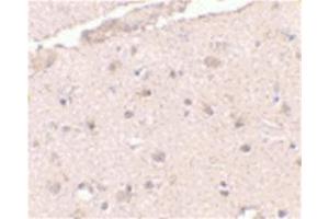 Image no. 2 for anti-BRCA1/BRCA2-Containing Complex, Subunit 3 (BRCC3) (N-Term) antibody (ABIN318911)