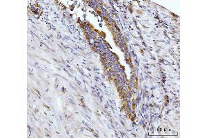 IHC analysis of Glutaminase/GLS using anti-Glutaminase/GLS antibody (ABIN7601602).