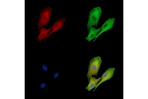 ABIN7096903 and ABIN7100969 staining  cells by IF/ICC. (DOLPP1 抗体)