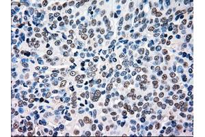 Immunohistochemistry (IHC) image for anti-B-Raf proto-oncogene, serine/threonine kinase (BRAF) antibody (ABIN1496954) (BRAF 抗体)