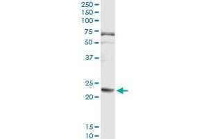 Immunoprecipitation of FGA transfected lysate using anti-FGA monoclonal antibody and Protein A Magnetic Bead , and immunoblotted with FGA MaxPab rabbit polyclonal antibody. (FGA 抗体  (AA 1-218))