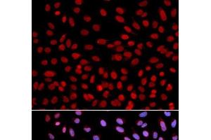 Immunofluorescence analysis of U2OS cells using DNA polymerase eta Polyclonal Antibody (POLH 抗体)