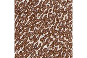 Immunohistochemical staining of human liver with ECH1 polyclonal antibody  shows strong cytoplasmic positivity in hepatocytes. (ECH1 抗体)