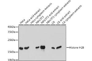 Western blot analysis of extracts of various cell lines, using Histone H2B antibody (ABIN7267736) at 1:1000 dilution. (HIST1H2BK 抗体)