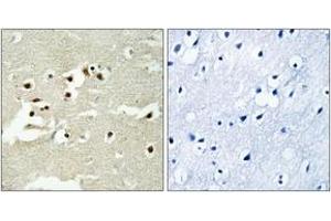 Immunohistochemistry analysis of paraffin-embedded human brain tissue, using NCOA5 Antibody.