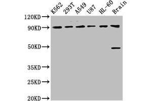 Western Blot Positive WB detected in: K562 whole cell lysate, 293T whole cell lysate, A549 whole cell lysate, U87 whole cell lysate, HL60 whole cell lysate, Rat brain tissue All lanes: OCA2 antibody at 8. (OCA2 抗体  (AA 2-136))