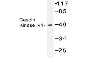Western blot (WB) analysis of Casein Kinase Igamma1 antibody in extracts from COS-7 cells. (CSNK1G1 抗体)