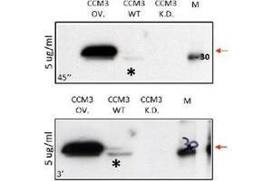 Western Blot using Anti Human CCCM3 antibody Cat. (PDCD10 抗体  (N-Term))