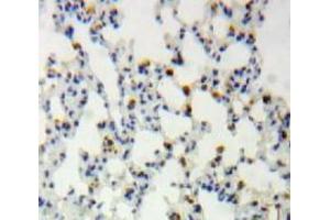 IHC-P analysis of Lung tissue, with DAB staining. (CLIC4 抗体  (AA 104-253))