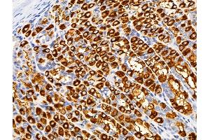 ABIN6259968 and ABIN6266497 at 1/100 staining Rat stomach tissue by IHC-P. (APAF1 抗体  (C-Term))