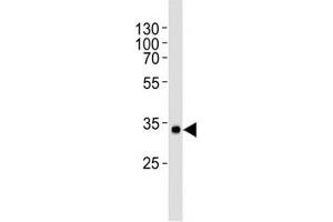 Western Blotting (WB) image for anti-Von Willebrand Factor (VWF) antibody (ABIN3029609)