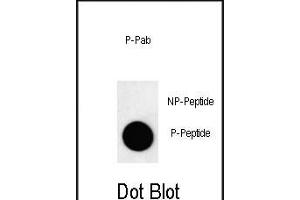 Dot blot analysis of anti-Phospho-G8b(M1LC3B)-T29 Antibody Phospho-specific Pab 3744a on nitrocellulose membrane. (APG8b (pThr29) 抗体)