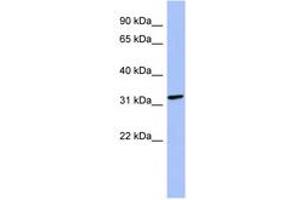 Image no. 1 for anti-Melanoma Antigen Family B, 2 (MAGEB2) (N-Term) antibody (ABIN6744050) (MAGEB2 抗体  (N-Term))