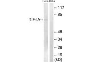 Western blot analysis of extracts from HeLa cells, treated with calyculinA 50ng/ml 30', using TIF-IA (Ab-649) Antibody. (RRN3 抗体  (AA 602-651))