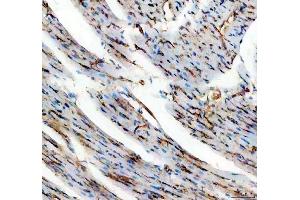IHC analysis of CD31/Pecam1 using anti-CD31/Pecam1 antibody (ABIN7601662). (CD31 抗体  (AA 41-258))