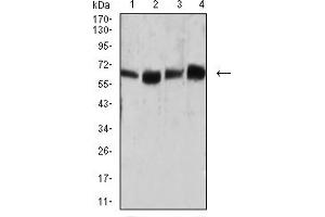 Western Blotting (WB) image for anti-Carcinoembryonic Antigen-Related Cell Adhesion Molecule 1 (CEACAM1) (AA 65-201) antibody (ABIN5684132)