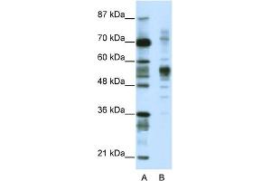 WB Suggested Anti-CORO1A Antibody Titration:  1. (Coronin 1a 抗体  (C-Term))
