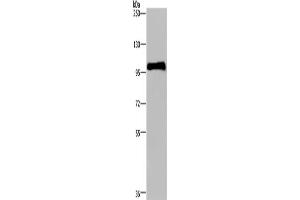 Western Blotting (WB) image for anti-Plasminogen (PLG) antibody (ABIN2435220) (PLG 抗体)