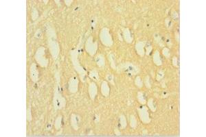 Immunohistochemistry of paraffin-embedded human brain tissue using ABIN7150825 at dilution of 1:100 (Dynamin 1 抗体  (AA 2-245))