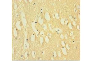 Immunohistochemistry of paraffin-embedded human brain tissue using ABIN7150825 at dilution of 1:100