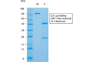 SDS-PAGE Analysis of Purified Thyroglobulin Rabbit Recombinant Monoclonal Antibody (TGB/1970R). (Recombinant Thyroglobulin 抗体)