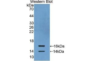Western Blotting (WB) image for anti-Chemokine (C-C Motif) Ligand 24 (CCL24) antibody (FITC) (ABIN1862929) (CCL24 抗体  (FITC))